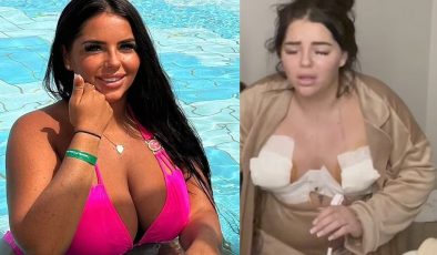 İngiltere ve Türkiye arasındaki estetik krizi büyüyor… Bir vaka daha…