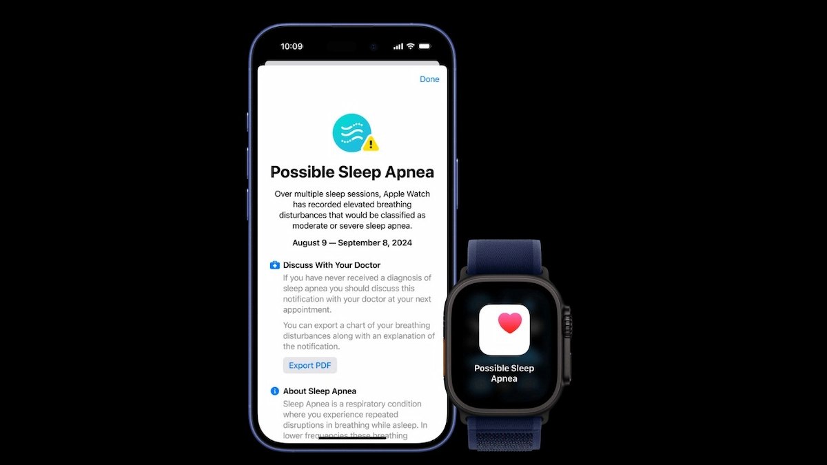 Apple Watch uyku apnesi tespit özelliği Türkiye’de kullanıma sunuldu